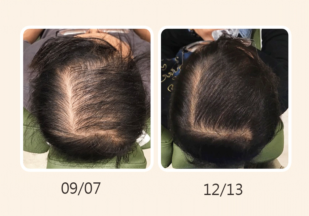 髮農 Hair Farm｜DR.GAGA 頭皮診間科學